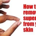 how to get super glue off skin