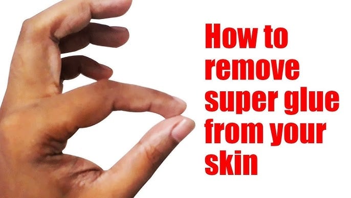 how to get super glue off skin