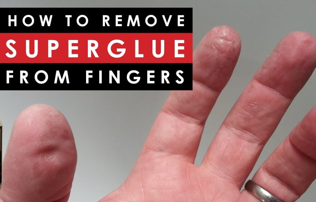 how to get super glue off skin